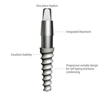 Имплантат «Соло»